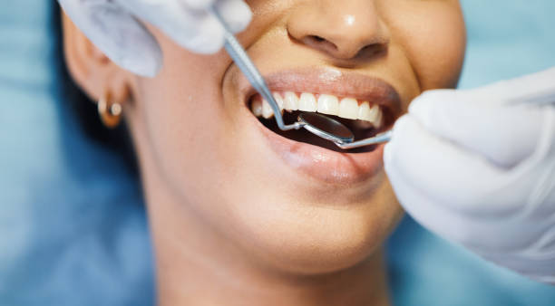 Best Dental Abscess Treatment in Portage, MI